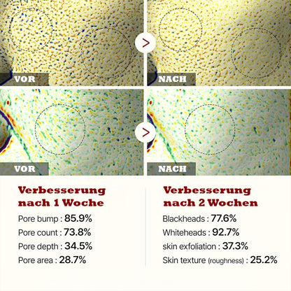 Reis-Peeling Duo – Für strahlende Haut