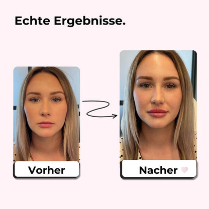 VolleLippen Boost Set