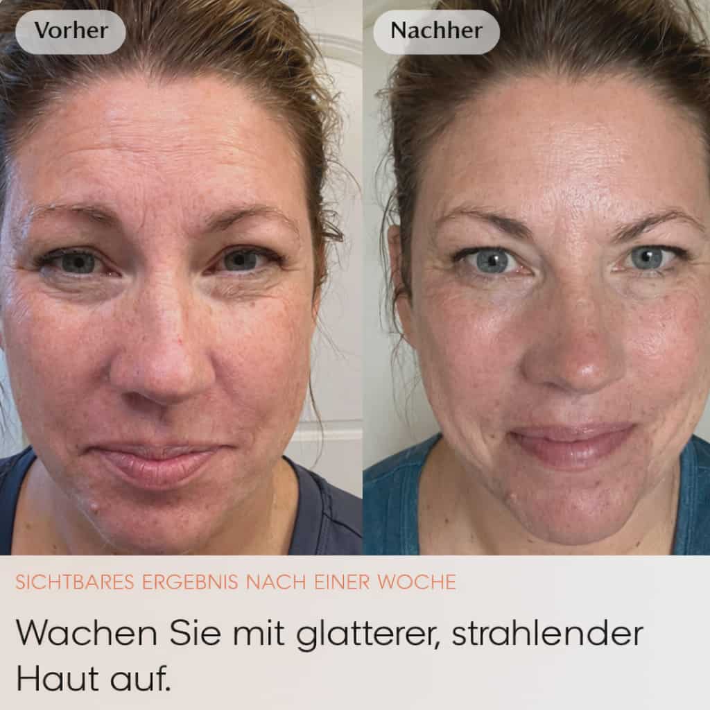 Friesto Kollagen-Nachtmaske