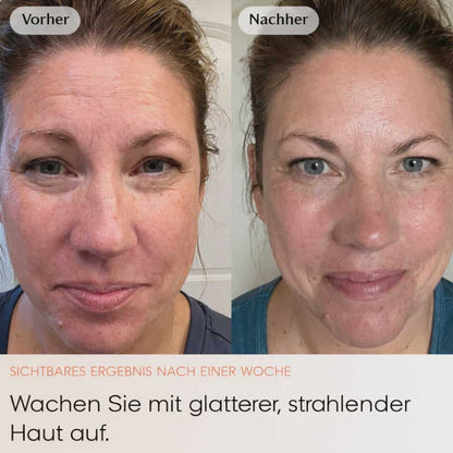 Friesto Kollagen-Nachtmaske